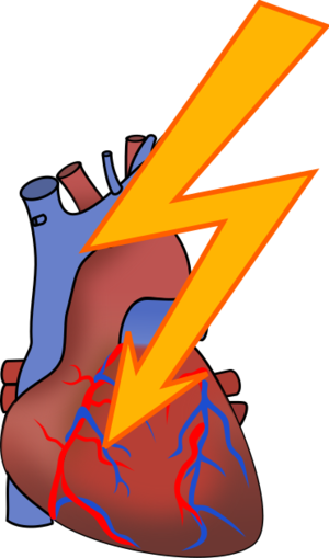 clip art clipart svg openclipart color sign symbol surgery smoke patient attack sickness heart cigarette illness smokers ill person effects skoke 剪贴画 颜色 符号 标志 心形 心脏